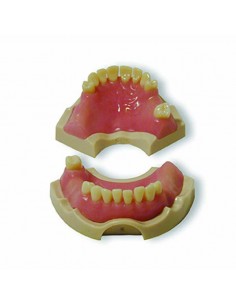 MODELO CASUISTICA PRACTICA IMPLANTES